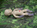 Acrocyanosis is normal for a newborn during the first few hours