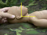 Proper airway positioning of newborn