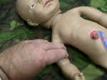 brachial artery pulse