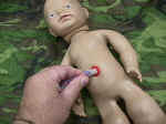 Umbilical artery pulse