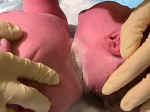 Vernix caseosum