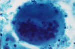 Atrophy_and_mnh_2250.jpg (11871 bytes)