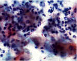 candida640.jpg (88899 bytes)