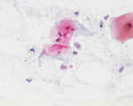 trich.jpg (138460 bytes)