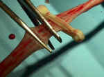 Clamp the umbilical cord