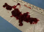 Curettings.jpg (90369 bytes)