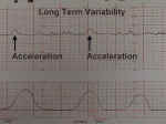 Long Term Variability