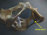 Ischial Spine