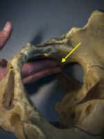 Ischial Spine