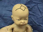 anterior fontanel