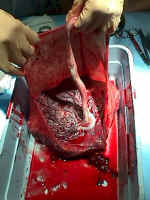 Inspect the placenta