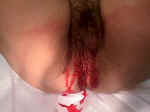 Vagbleed1.jpg (52518 bytes)