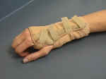 WristSplint.jpg (45873 bytes)