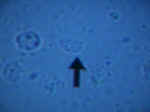 TrichMicro.jpg (41776 bytes)