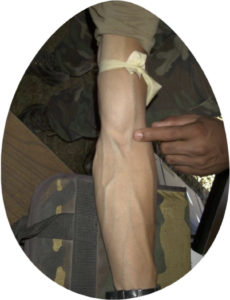 2.2 Terms 2 Arm showing veins