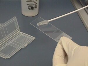 Preparing a Pap smear using the glass slide technique