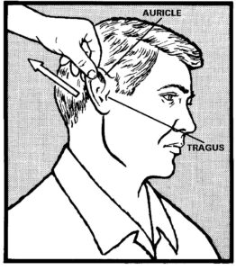 Demonstration of Movement of the auricle.