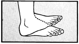 drawing showing Dorsiflection of the foot