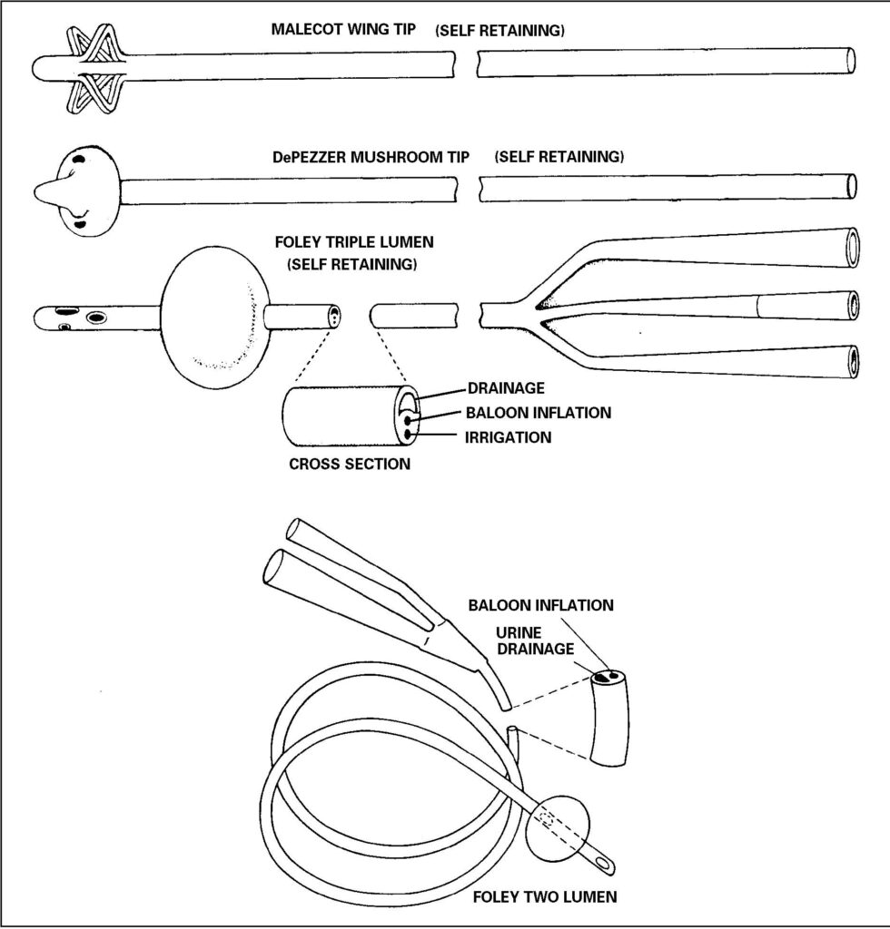 Urinary catheters.