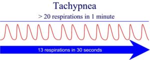 graphic showing Tachypnea - Rapid Breathing